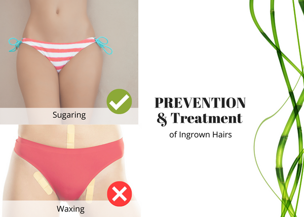 Ingrown hairs from sugaring Clearance